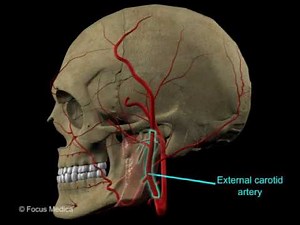 Parotid gland, infratemporal fossa and submandibular gland Head & Neck