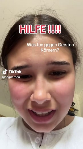 Effective Remedies for Gerstenkorn Treatment