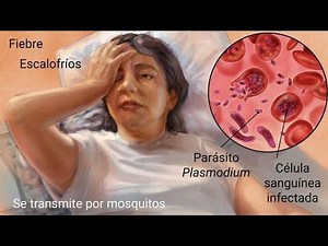 Que es el Paludismo o la Malaria? Síntomas, Diagnóstico, Tratamiento y Prevención.
