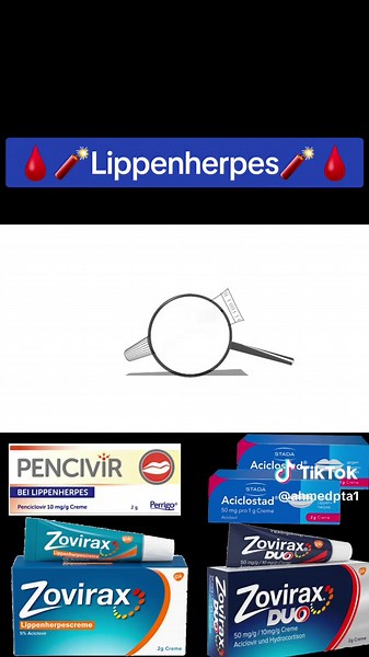 Lippenherpes: Ursachen, Symptome und Behandlung