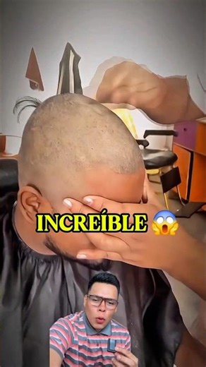 COMO ELIMINAR LA CASPA EN CASA 😱 #caspa #barbershop #profesional #barber #barbero #barberia #shorts