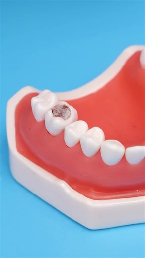 Understanding Dental Surgery: What to Expect