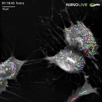 𝗛𝗮𝗽𝗽𝘆 𝗯𝗶𝗿𝘁𝗵𝗱𝗮𝘆 𝘁𝗼 𝘁𝗵𝗲 𝗦𝗺𝗮𝗿𝘁 𝗠𝗶𝘁𝗼𝗰𝗵𝗼𝗻𝗱𝗿𝗶𝗮𝗹 𝗔𝘀𝘀𝗮𝘆 𝗟𝗜𝗩𝗘!