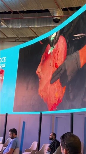 Live Cadaver From ICCCE Conference at EICC - Cairo Egypt