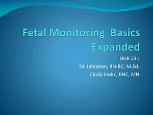Fetal Monitoring Basics Expanded - SlideServe
