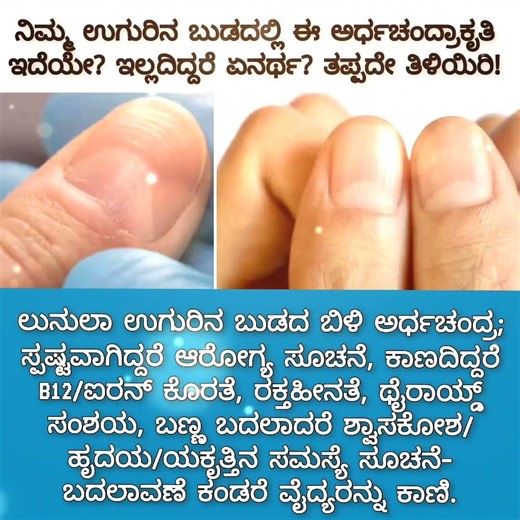 ನಿಮ್ಮ ಉಗುರಿನ ಬುಡದಲ್ಲಿ ಈ ಅರ್ಧಚಂದ್ರಾಕೃತಿ ಇದೆಯೇ? ಇಲ್ಲದಿದ್ದರೆ ಏನರ್ಥ? ತಪ್ಪದೇ ತಿಳಿಯಿರಿ!