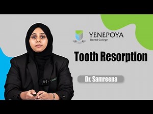 Tooth Resorption | Conservative Dentistry & Endodontics | Yenepoya Dental College