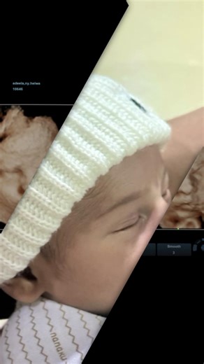 Perjalanan Hamil 11 Bulan M. Almeer Zavir