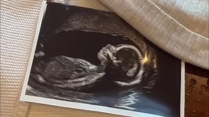 Cher Lloyd shares adorable photos with newborn baby and daughter