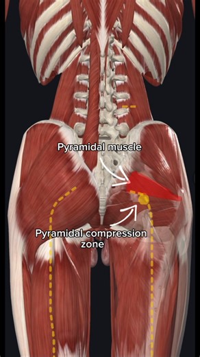 These are the different areas of compression of the sciatic nerve, the pain they generate and how to solve it #physiotherapy #pain #sciatic #rehab | Global Fisio