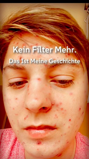 Kein Filter mehr. Nur Wahrheit. Wir haben gelernt, uns zu verstecken. Ein Pickel? Problem. Poren? Fehler. Echte Haut? Zu echt für diese Welt. Aber irgendwann reicht’s. Dann stehst du auf, blickst in den Spiegel und erkennst: Du warst nie das Problem. Die Lüge war’s. 💥 Dieses Video ist für alle, die aufgehört haben, sich zu verstecken. Und für die, die noch auf dem Weg sind. Du bist nicht zu viel. Du bist nicht zu echt. Du bist du. Und das reicht. 🧡 Schreib „ECHTE HAUT“ in die Kommentare, wenn 