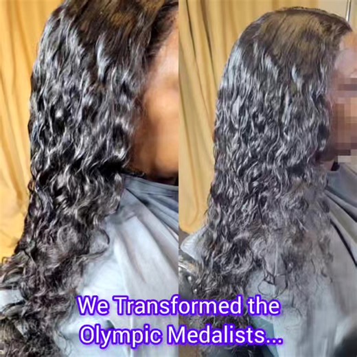 2.9K views | Do you want to look and feel better with Alopecia Hair...