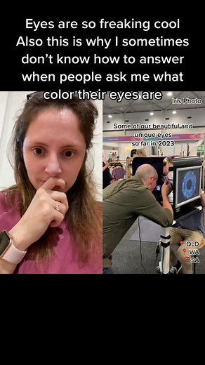 #duet with @iris_photo #trending iris’s are so cool! #eyedoctorsbelike #iriscolor