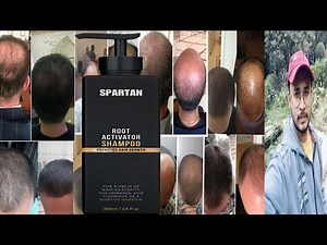 Spartan Root Activator Hair Growth Shampoo | Honest Review
