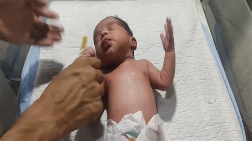 🍼 “Tiny Miracle: Premature Baby Feeding Time in NICU | So Adorable Welcome to our neonatal care channel, where we share essential tips, educational content, and expert insights on newborn health and premature baby care. In this video, we cover the basics of neonatal care, including feeding, hygiene, temperature regulation, and common conditions in the NICU.#NeonatalCare #NewbornCare #NICU #PrematureBaby #PreemieSupport #NeonatalNursing #NewbornHealth #InfantCare #NICULife #BabyCare#NewParents #