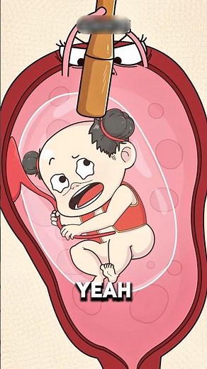 Why Some Babies Are Born Inside the Amniotic Sac 👶✨..!!#e2dhealth #animation #2dshow #fypシ #health