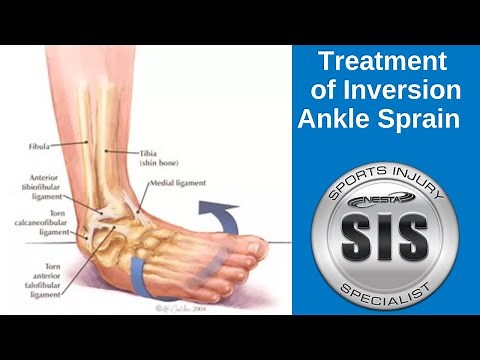 Inversion Ankle Sprain Treatment