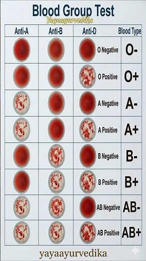 Blood Group Test Trick in 7 Seconds 🩸🔥