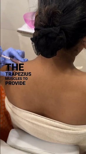 “TrapTox” - Botox Treatment for Shoulders & Neck!