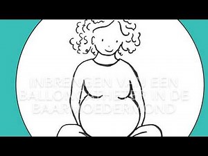 Inleiding van de bevalling