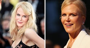 Nicole Kidman before and after pics: The truth behind her youthful look