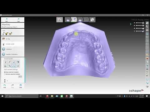 How to Export a Hollowed Orthodontic Study Model in 3Shape