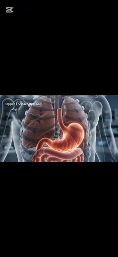 Step Inside the Upper Digestive Tract: Watch Full EGD Procedure! Short part 2
