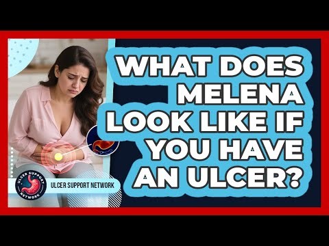 What Does Melena Look Like If You Have An Ulcer?