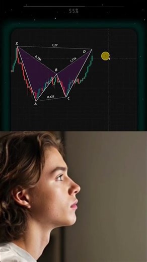 "99% Traders Ignore This Pattern! 🚫 (Free Guide in Comments)"