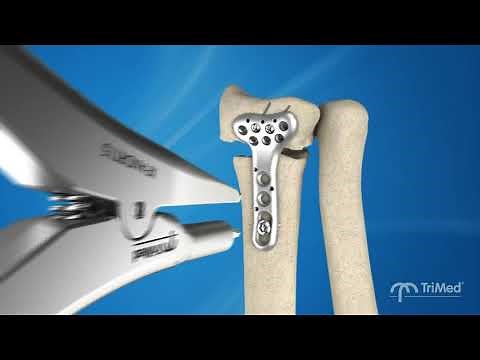 Restore the DRUJ like magic!