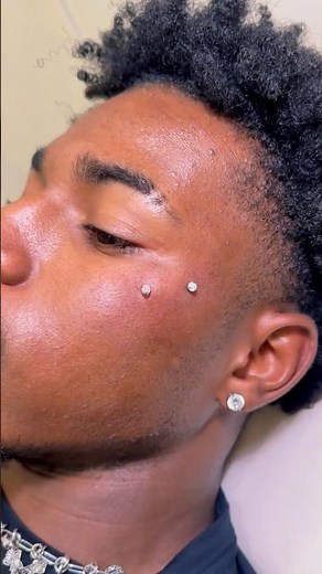 Surface Dermal Piercing ⭐️