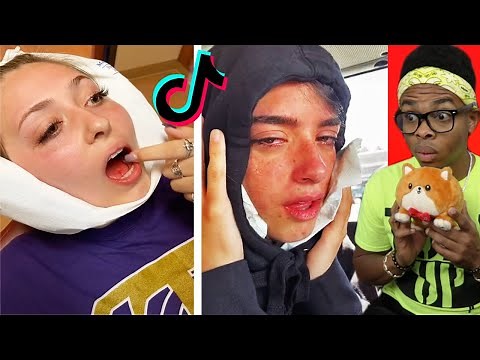 Funniest Wisdom Teeth Removal Tik Toks