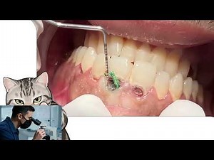 What Expect!😮Professional Teeth Cleaning A Dentist's Step-by-Step #0015