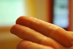 10 best essential oils for warts removal - Essential oils to ged rid of Verruca 2017