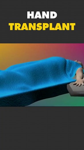 Human Hand Transplant Procedure 3D Animation #handtransplant #handtransplantsurgery #handtransplantworkout #handsurgery #handsurgerytoday #handfracture #handbroke #handbroken #handbroken😭 #transplantsurgery #medical3danimation #3dmedicalanimation