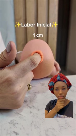 Understanding Cervical Dilation: A Comprehensive Guide