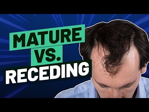 Mature Hairline Versus Receding Hairline - How To Tell The Difference