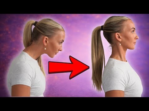 3 steps to FIX A NECK HUMP | Doctor and Physiotherapist demonstrate