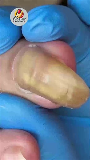 33K views · 191 reactions | Easy Routines That Help Nail Pain Using Safe At-Home Techniques #HealthyNails #ToenailRoutine #CleanNailsDaily #NailCareTips | Evgeniy | Facebook