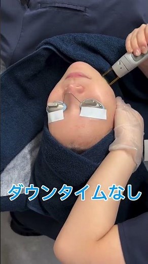 💎 医療用レーザー💎で美肌！【詳しい内容は本文の説明にて！】