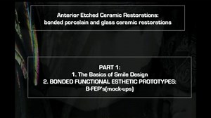 The Bonded Functional Esthetic Prototype BFEP (Bonded Mock-up)