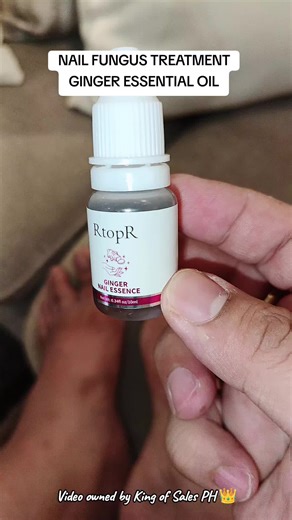 Ginger Essential Oil: Effective Nail Fungus Treatment