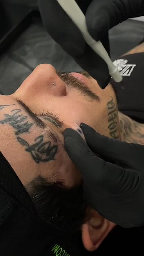 Unique Tear Drop Dermal Piercing Explained