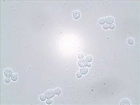 Budding and Shmooing - Yeast Reproduction