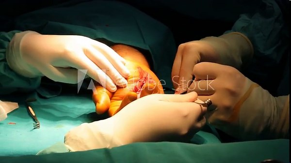Hand surgery, expert healthcare and specialized treatment for hand trauma and injuries.