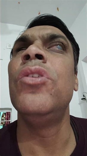 Update of AutoTTS Version 7 November 2025 compatible with Android 16FastVoiceScaningBugFixed