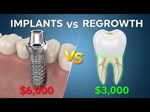 Tooth Regeneration vs Dental Implants: Cost Comparison 2025 | Medical Miracle