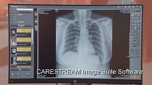 Image Suite V4 Software has set a new benchmark for workflow efficiency in smaller facilities. This robust software features an easy-to-use, touch-friendly interface, an enhanced set of tools, streamlined workflow and improved image quality. Our advanced optional "mini-PACs" module allows superb image management and analysis. Get the high-quality images you need with a system that's a perfect fit - at an affordable price. | Carestream
