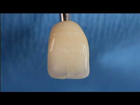 MiYO 850 Training for e.max Anteriors
