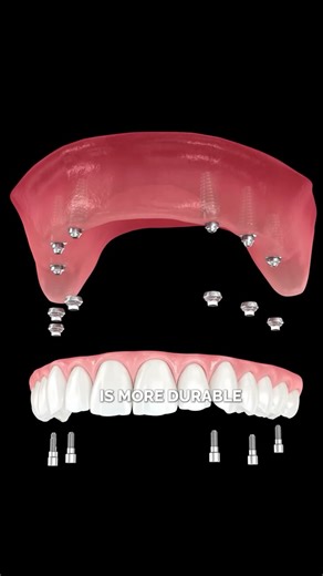 Dental Design Smile on Instagram: "✨ Witness the magic of your first smile moment! At Dental Design Smile, every transformation is crafted with precision, harmony, and artistry — because your smile deserves nothing less. 💎 From your first consultation to your final reveal, our team ensures a luxury experience with free VIP transportation and hotel stay in Miami. 🌴 📩 DM us “MIAMI” to begin your smile transformation today. #DentalDesignSmile #MiamiSmile #SmileTransformation #PorcelainVeneers #S